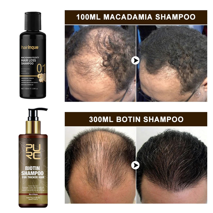 Shampoo for Hair Fast Growth Treatment  Products