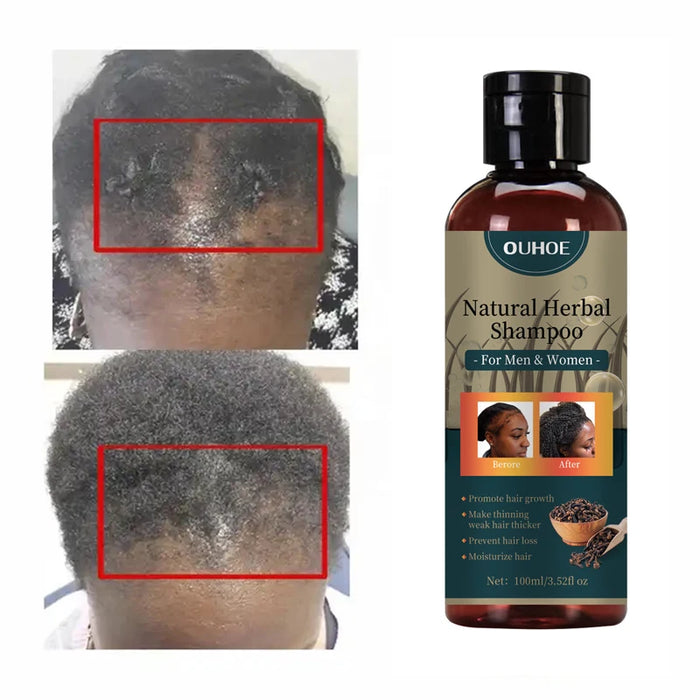 Natural Herbal Shampoo - Hair Growth Formula - Powerful & Fast-Acting Treatment for Fuller & Thicker Hair - Suitable for All Hair Types