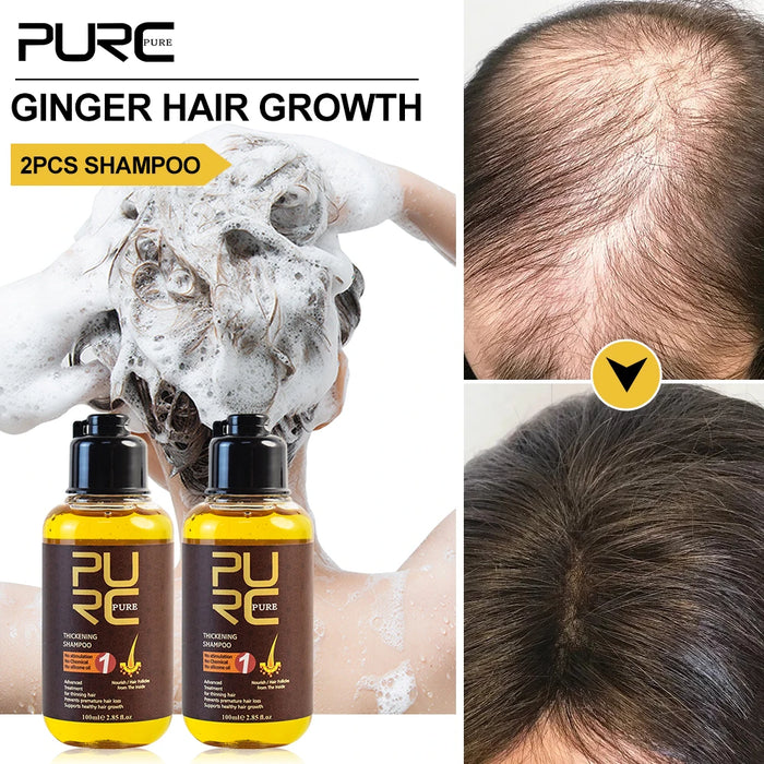 Hair Growth Shampoo - Anti Hair Loss Formula for Scalp Treatment - Promotes Healthy Hair Growth - Suitable for All Hair Types