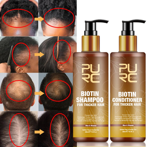 PURC Fast Hair Growth Products for Men - Biotin Infused Formula for Thicker Hair - Reduces Hair Loss & Stimulates Regrowth - Perfect for All Hair Types