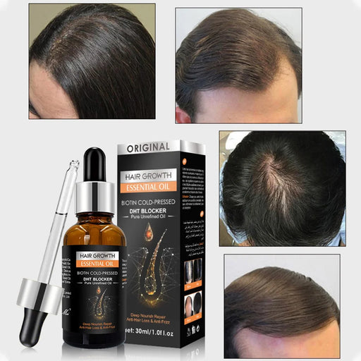 Hair Growth Essential Oil Biotin Cold-Pressed