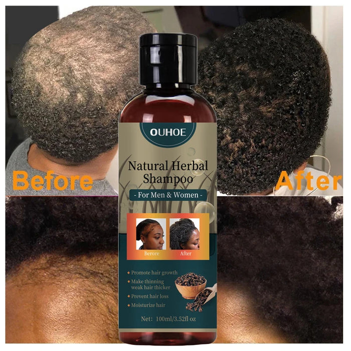 Natural Herbal Shampoo - Hair Growth Formula - Powerful & Fast-Acting Treatment for Fuller & Thicker Hair - Suitable for All Hair Types